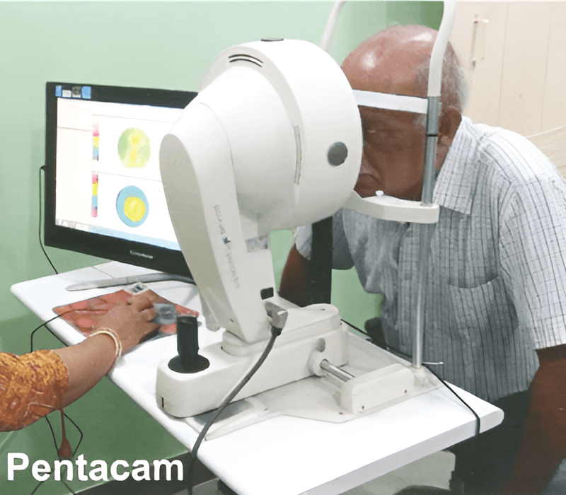 Pentacam